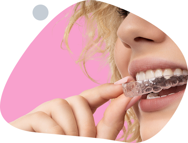 Clear Aligner Therapy